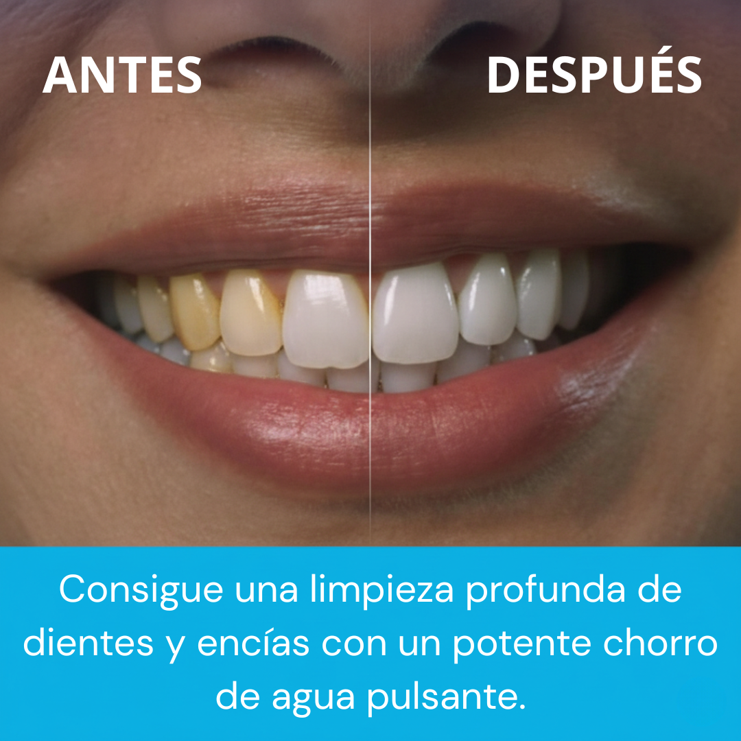 Limpieza Dental Profesional Desde Casa