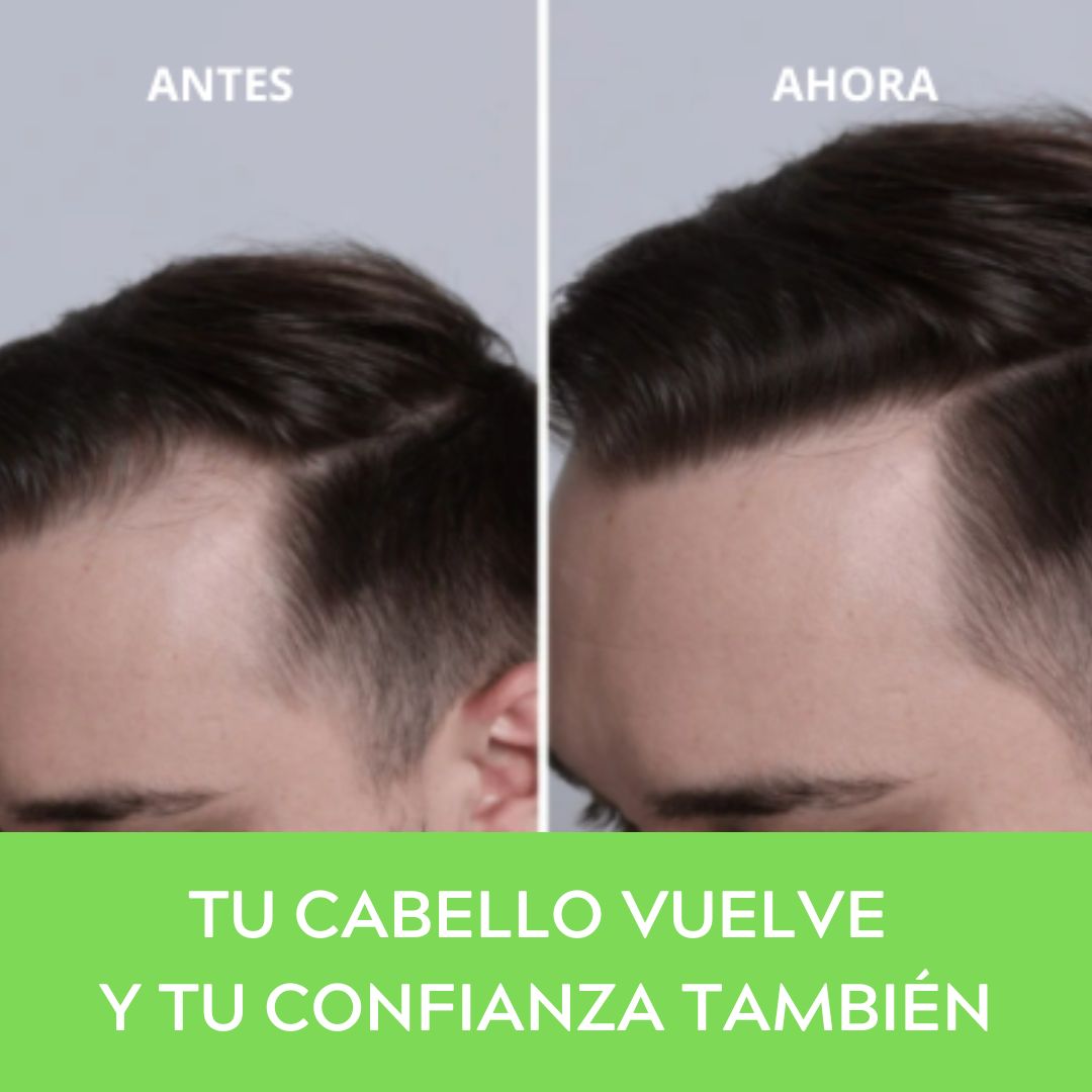 Cepillo Masajeador Capilar - Estimula el Crecimiento