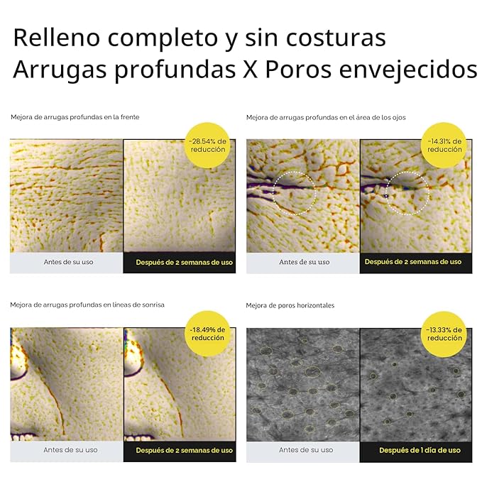 EL ANTIEDAD MÁS VIRAL: CELIMAX RETINAL SHOT