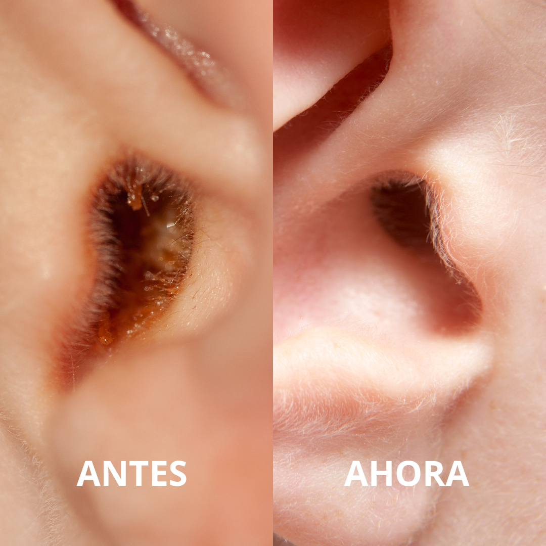 Limpiador De Oídos Con Cámara HD