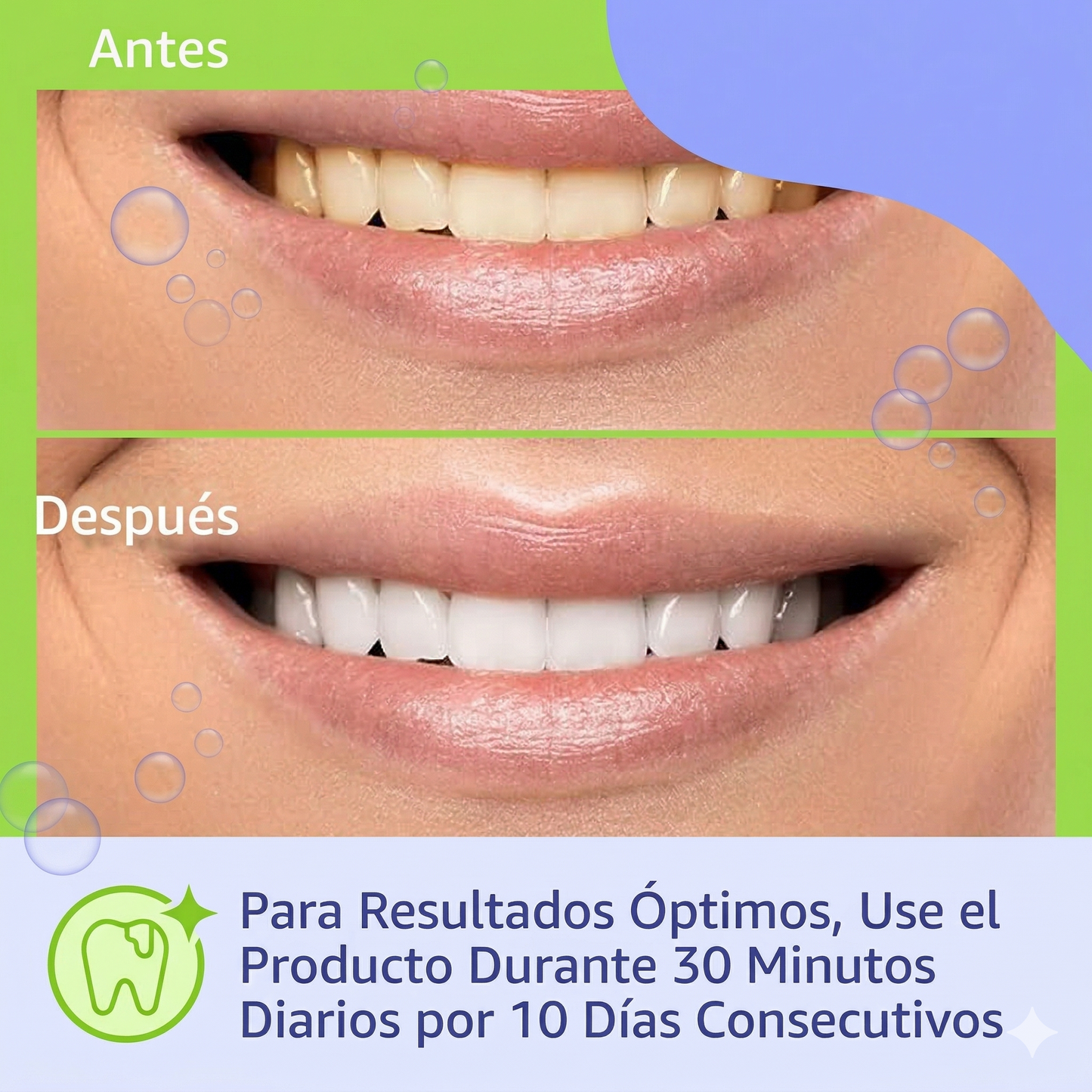 NO MAS DIENTES AMARILLOS: TIRAS BLANQUEADORAS DENTALES 1 CJA X7 PARES